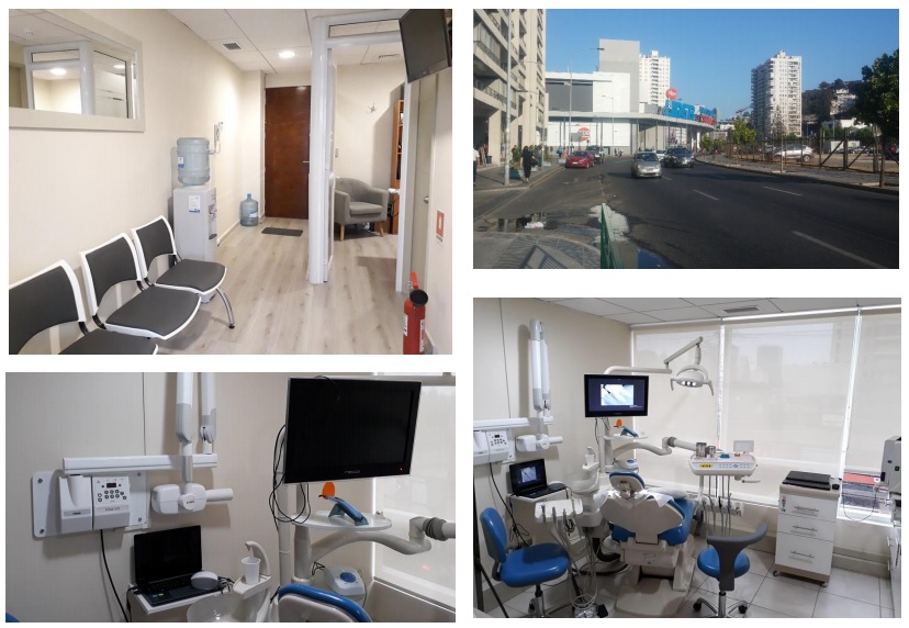 Procedimiento de endodoncia